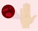 Anemia: A Common Side Effect of Heavy Periods